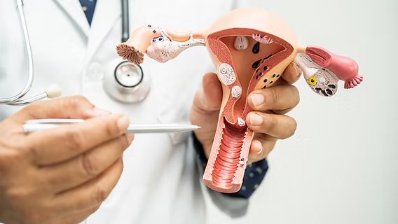 شكل لحمية الرحم: الأعراض، الأسباب، وطرق العلاج